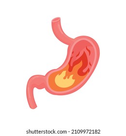 Heartburn in the stomach. Unhealthy stomach concept. Vector illustration in flat style.