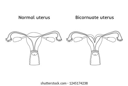 Uterus Handlebars Art Print