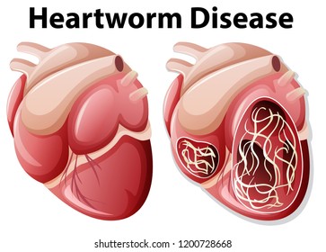 Heartworm disease diagram white background illustration