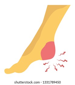 Heel pain flat icon design 