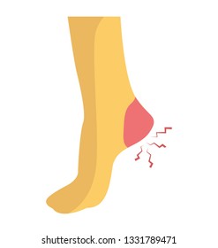 Heel pain flat icon design 