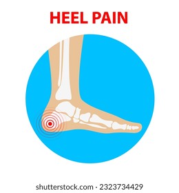 Heel pain. Human ankle joint icon back view. Vector illustration.