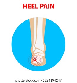 Heel pain. Human ankle joint icon back view. Vector illustration.