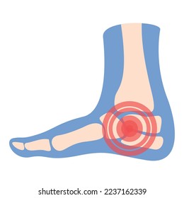 Heel pain icon cartoon vector. Arthritis joint. Medical treatment