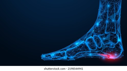 Ferse Sporen, Verletzung des Plantarligaments des Beins. Polygonale Konstruktion von miteinander verbundenen Linien und Punkten. Blauer Hintergrund.