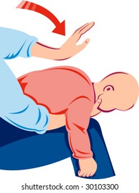 Heimlich Maneuver On Infant