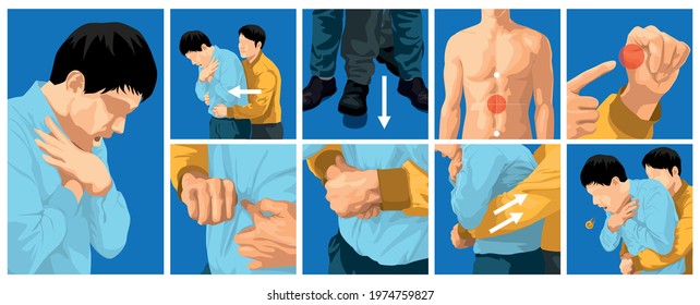 Heimlich maneuver vector illustration. first aid to choking for adults.