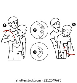 La maniobra de Heimlich. Procedimiento de primeros auxilios para el estrangulamiento debido a la obstrucción del tracto respiratorio superior por parte de cuerpos extraños. Ilustración plana del vector