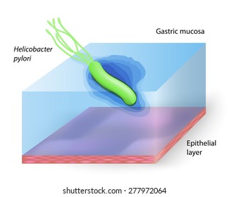 helicobacter pylori. bacterium