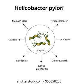 Helicobacter pylori. Diseases caused by Helicobacter pylori. Helicobacter infection. Infographics. Vector illustration.