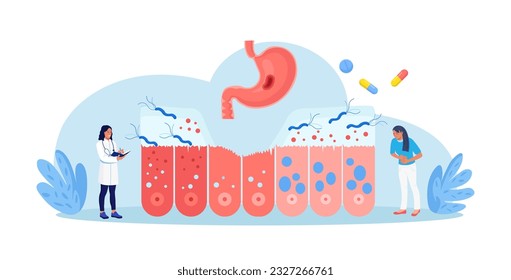 Helicobacter pylori infection. Bacterium with flagella damage stomach tissue. Digestive tract diseases, gastritis. Doctor inspecting stomach, intestine microflora, gut microorganisms. Gastroenterology
