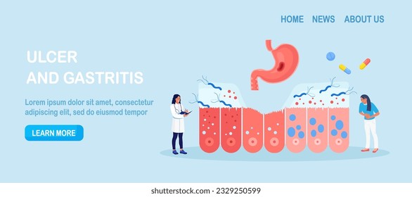 Helicobacter pylori infection. Bacterium with flagella damage stomach tissue. Digestive tract diseases, gastritis. Doctor inspecting stomach, intestine microflora, gut microorganisms. Gastroenterology
