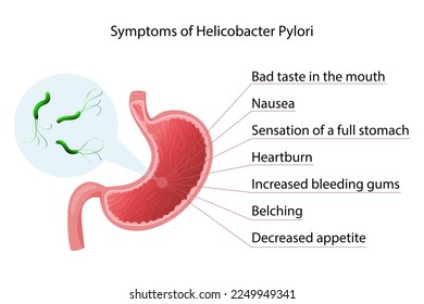 Helicobacter pylori infection symptoms infographic. Vector illustration, cartoon style, white background
