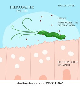 Helicobacter pylori in mucosal layer in stomach infographic. Vector illustration, cartoon style
