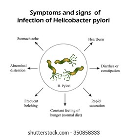 Helicobacter Pylori. Symptoms Of Infection. Infographics. Vector Illustration.