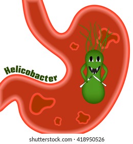 Helicobacter pylori. Ulcers. The disease of the stomach and duodenum. ?aricature, cartoon.