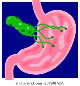 Helicobacter pylori vector illustration. Hand-drawn stomach, bacteria. Bright informational medical image. Disease of the stomach, duodenum, esophagus. Cartoon anatomy of abdominal organs. Be healthy