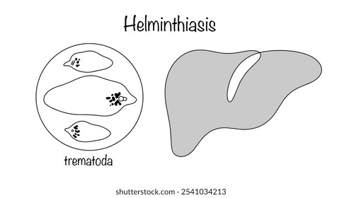 Helminths that infect the liver. Hand-drawn flukes, which are the leading cause of liver damage among helminths. Parasitic flatworms and the human liver. Isolated vector on white background.