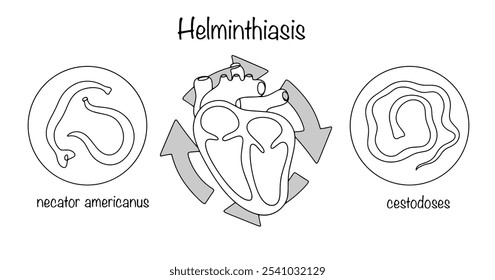 Helmintos, que, al entrar en el cuerpo humano, tienen un efecto negativo en el sistema circulatorio. Parásitos dibujados a mano y el corazón como el órgano principal del sistema circulatorio humano. Vector.