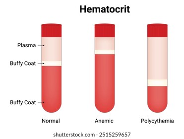 Diagrama de Ilustración vectorial de diseño de Ciencia de hematocrito