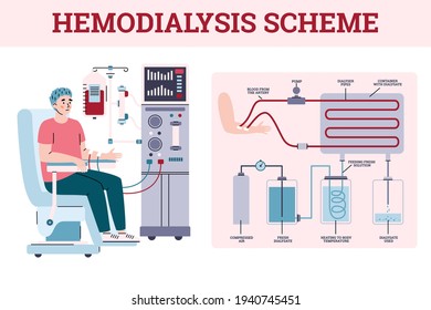 Hemodialysis renal scheme with equipment for treatment kidney diseases failure