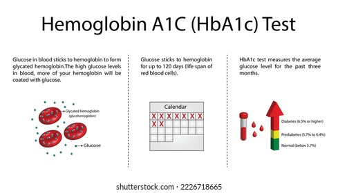 Hämoglobin-A1C, HbA1c-Test, HbA1c-Spiegel, Glucose-Stöcke auf   Hämoglobin, glykosyliertes Hämoglobin, bis zu 120 Tage. A1C Blutzuckertest, Diabetes mellitus, Infografik, Vektorgrafik.