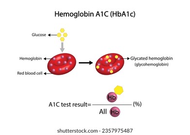 Hemoglobina A1C, HbA1c test, HbA1c level, Glucosa se aferra a la hemoglobina, hemoglobina glicarizada, hasta 120 días. Prueba de azúcar en sangre A1C, Diabetes Mellitus, Infografía, Ilustración vectorial.