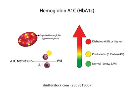 Hemoglobina A1C, HbA1c test, HbA1c level, Glucosa se aferra a la hemoglobina, hemoglobina glicarizada, hasta 120 días. Prueba de azúcar en sangre A1C, Diabetes Mellitus, Infografía, Ilustración vectorial.