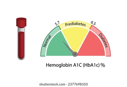 Hemoglobina A1C, HbA1c resultados de las pruebas, hemoglobina glicarizada, A1C Análisis de azúcar en sangre, Diabetes Mellitus. Ilustración vectorial.