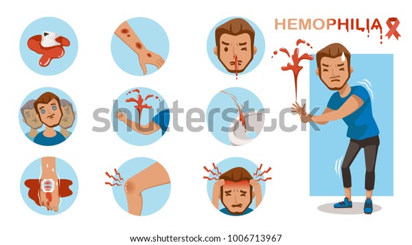 輪の中の血友病症状インフォグラフィック 出血が多過ぎる 目まい ぼやけた視力 出血 血の尿 腫れた関節痛 激しい痛み ベクターカートーンイラスト のベクター画像素材 ロイヤリティフリー