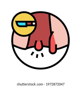 hemorrhoids disease color icon vector. hemorrhoids disease sign. isolated symbol illustration