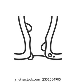 Hemorrhoids of the rectum, linear icon, hemorrhoidal nodes on the walls of the rectum. Line with editable stroke