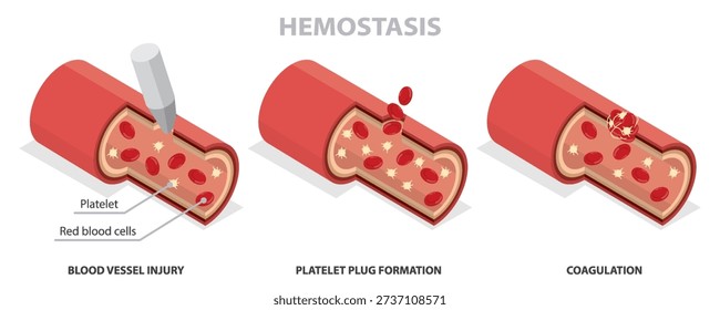 Hemostasis. Wound healing process stages (blood vessel injury, platelet plug formation, coagulation). Blood clotting concept. 3d flat isometric vector illustration poster. 