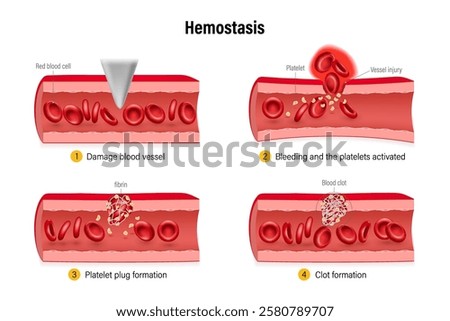 Hemostasis. Wound Healing Process Stages. Process to prevent and stop bleeding. Vasoconstriction, platelet plug and blood coagulation.