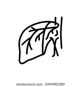 Icono de línea negra de hepatectomía. Operaciones en la cavidad abdominal. Vector elemento aislado. 