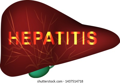 Hepatitis A, B, C, D, E, F, G. World Hepatitis Day. Infographics. Vector illustration on isolated background.