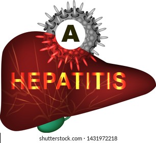 Hepatitis A. World Hepatitis Day. Infographics. Vector illustration on isolated background.