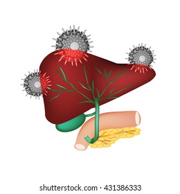 Hepatitis C. The introduction of the hepatitis C virus in the liver. The structure of the digestive system. Gallbladder. Pancreas. Bile ducts. Duodenum. World Hepatitis Day. Vector illustration.