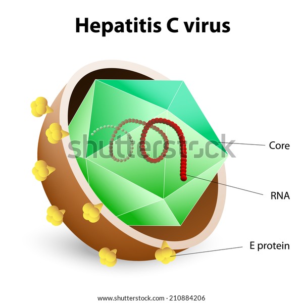 Hepatitis C Virus Hcv Hepatitis Inflammation Stock Vector Royalty Free 210884206