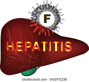 Hepatitis F. World Hepatitis Day. Infographics. Vector illustration on isolated background.
