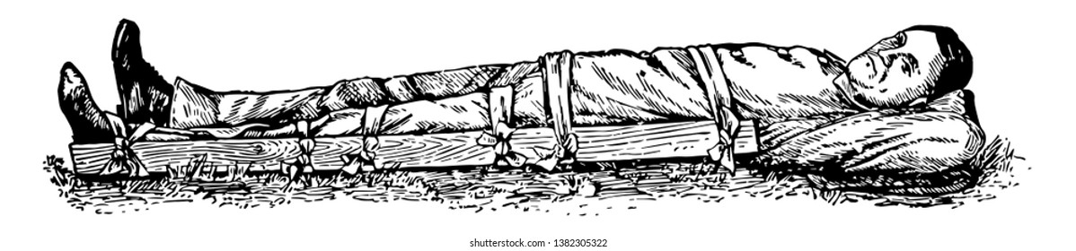 Here a man is lying, whose leg is tied with a piece of wood, vintage line drawing or engraving illustration.