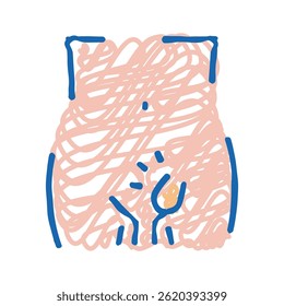 hernia inguinal disease doodle icon sketch vector. hernia inguinal disease sign. isolated symbol illustration