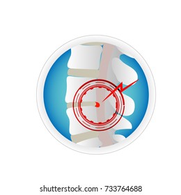 herniated disc spine bone and nerve close up spinal coard concept health care