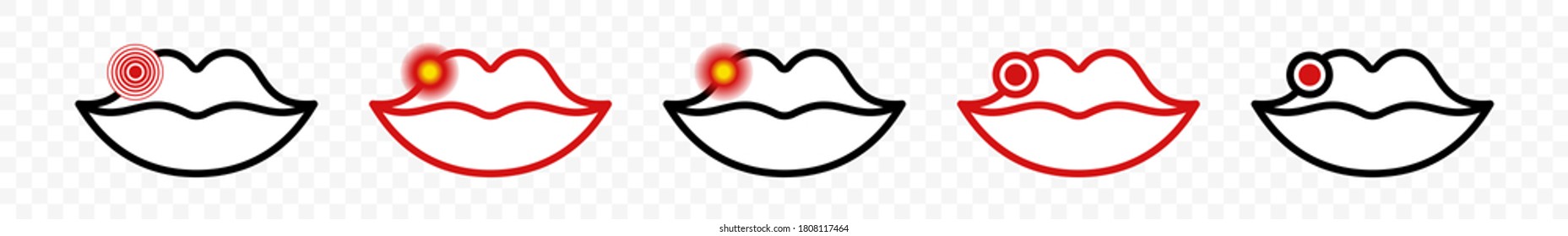 Icono de labios de herpes. Virus herpes simple. Símbolo de inflamación de la infección labial. Diseño lineal plano para medicamentos o envases de lápiz labial. Ilustración vectorial.