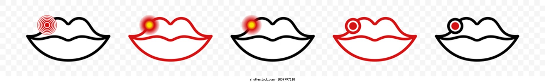 Icono de labios de herpes. Virus herpes simple. Símbolo de inflamación de la infección labial. Diseño lineal plano para medicamentos o envases de lápiz labial. Ilustración vectorial.