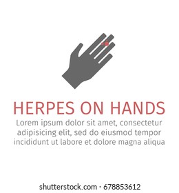Herpes on hands. Vector icon.