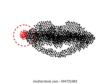 Herpes on lips. Dotted design lips close up infected by herpes virus  vector illustration isolated on white background.