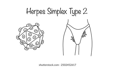 Herpes virus type 2. An infectious disease characterized by involvement of the genital organs in the pathological process. Medical black and white illustration for different uses.