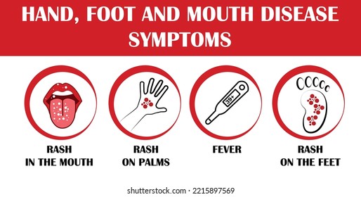 HFMD children infected. hand foot and mouth disease.