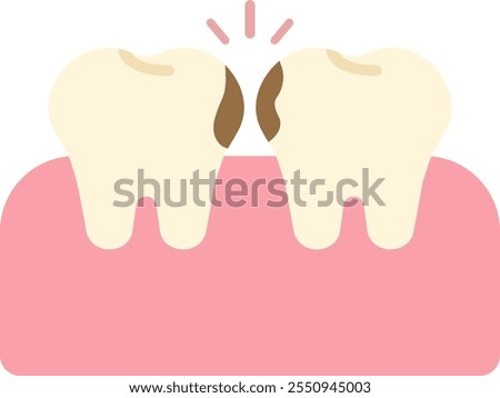 hidden cavity caried tooth caries carious tooth dental oral care